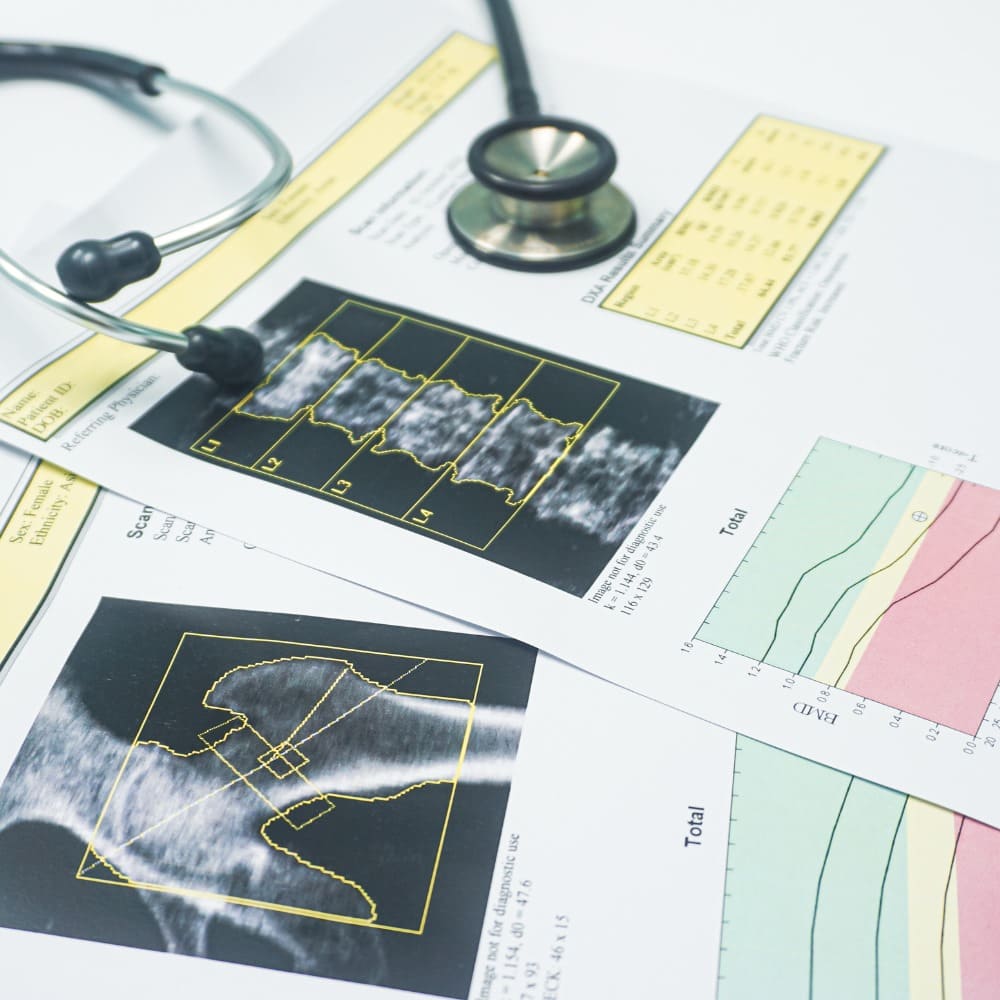 Bone Density imaging